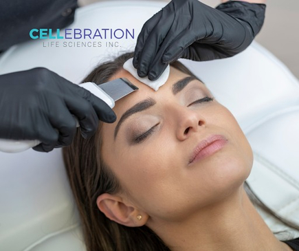 Slider image (5) Cellebration Wellness - Stem Cell Clinic San Jose